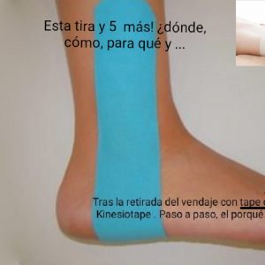 Kinesiotape post-alta esguince de tobillo